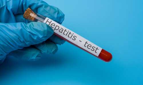 Alerta por Hepatitis Aguda Infantil en el mundo